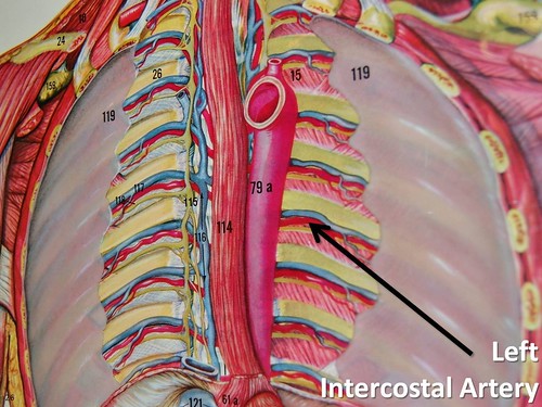 Left intercostal artery - The Anatomy of the Arteries Visu… | Flickr