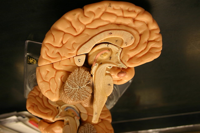 Midsagittal Section Human Brain | Flickr - Photo Sharing!