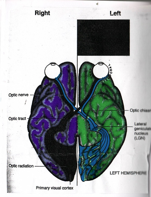 Left/Right Brain | Diagram of how the left and right sides ...