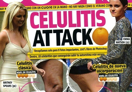 celulitis_attack