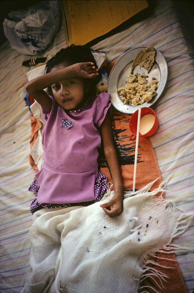 Child Sick with Malaria, Southern Mexico | by Marcelo  Montecino
