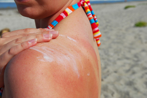 Joel Schlessinger MD explains what happens to your skin when you get a sunburn