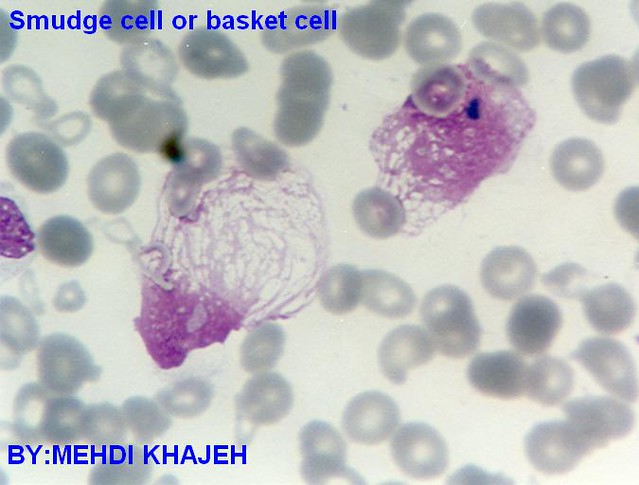 Hematology Analyzers—From Complete Blood Counts to Cell Morphology