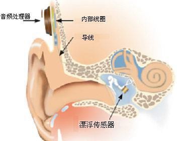 Smart device step by step how to save our hearing?
