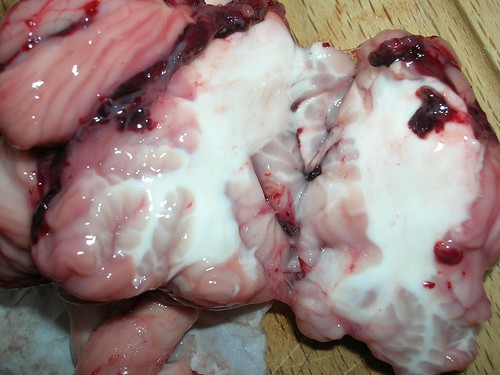 fig. 26: sezione di cervello con sostanza grigia esterna e sostanza bianca interna