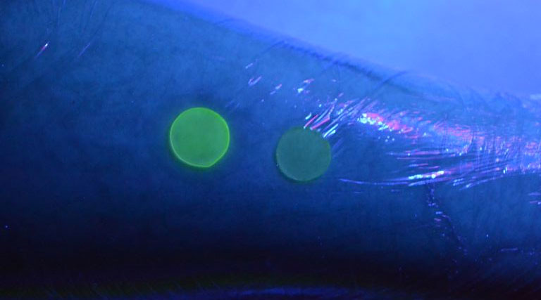 Close up of the light-up prototype burn dressing on an arm