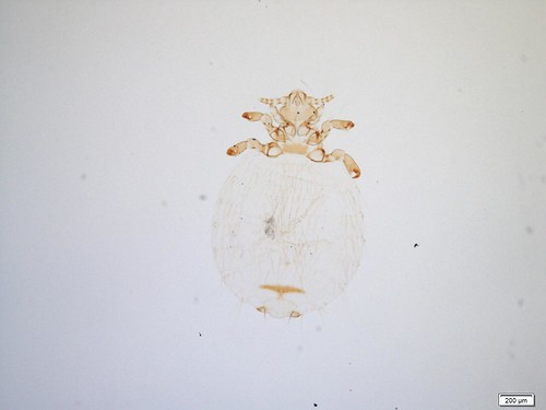 Microscopic image of an anoplura with a rotund body and short setae.