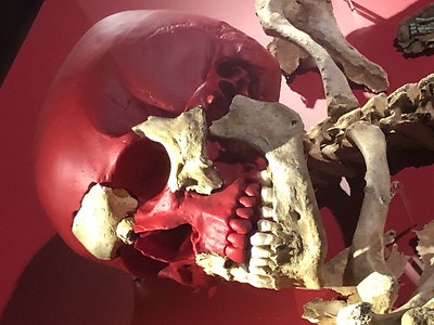 Waterloo skull