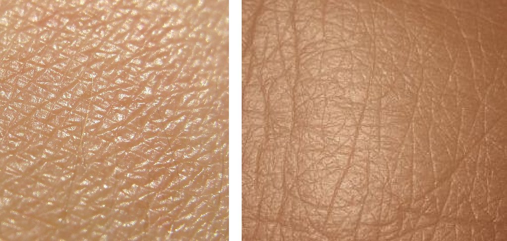 除皺很簡單，雷射除皺讓皮膚緊緻毛孔縮小，雷射除皺要靠皮秒雷射，皮秒雷射是最新的雷射除皺機器。最簡單的毛孔縮小辦法，美上美皮膚科的皮秒雷射讓您一勞永逸。
