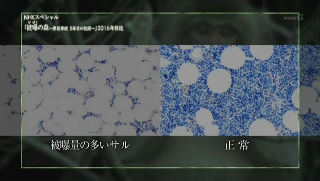 圖四：輻射被曝的日本獼猴，和正常的日本獼猴，不同的造血幹細胞分佈狀況，白色的是脂肪，點點的是造血幹細胞。