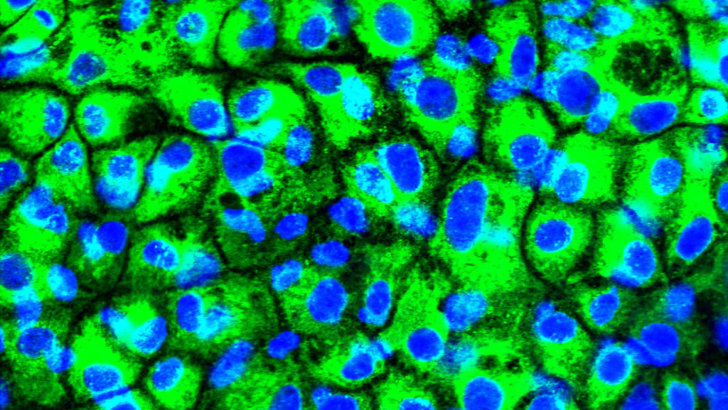 Our scientists have developed a more simple process to create precursor liver cells, allowing the scale on which they can be created to be increased.