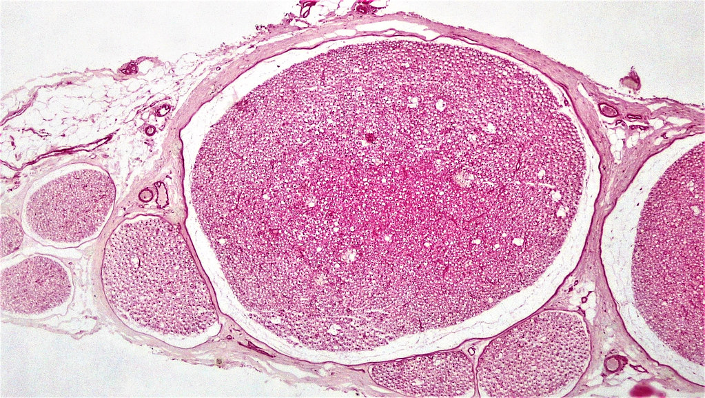 nervous-tissue-nerve-bundle-cross-section-nerve-magnific-flickr