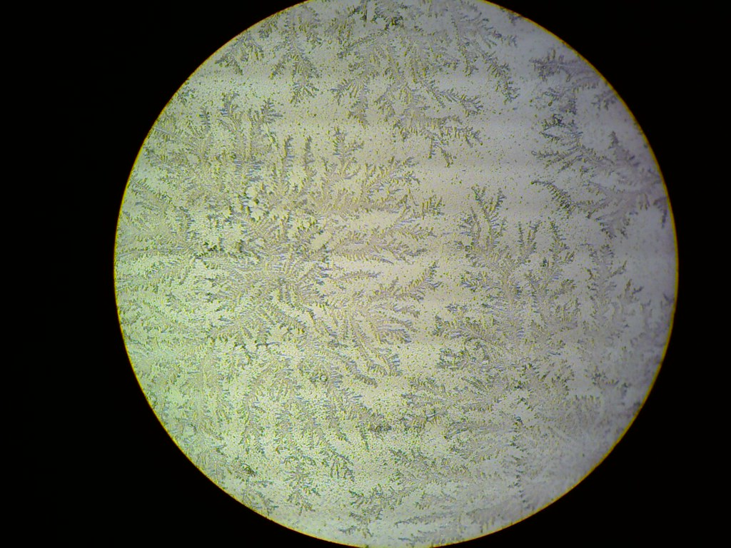 positive-fern-test-aka-amniotic-fluid-crystallization-test-paul