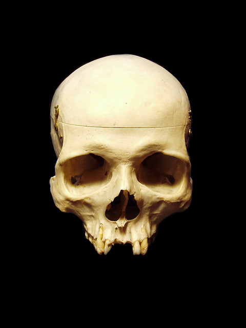 Doris - skull(lower jaw removed) | Doris is my 150yr old fem… | Flickr