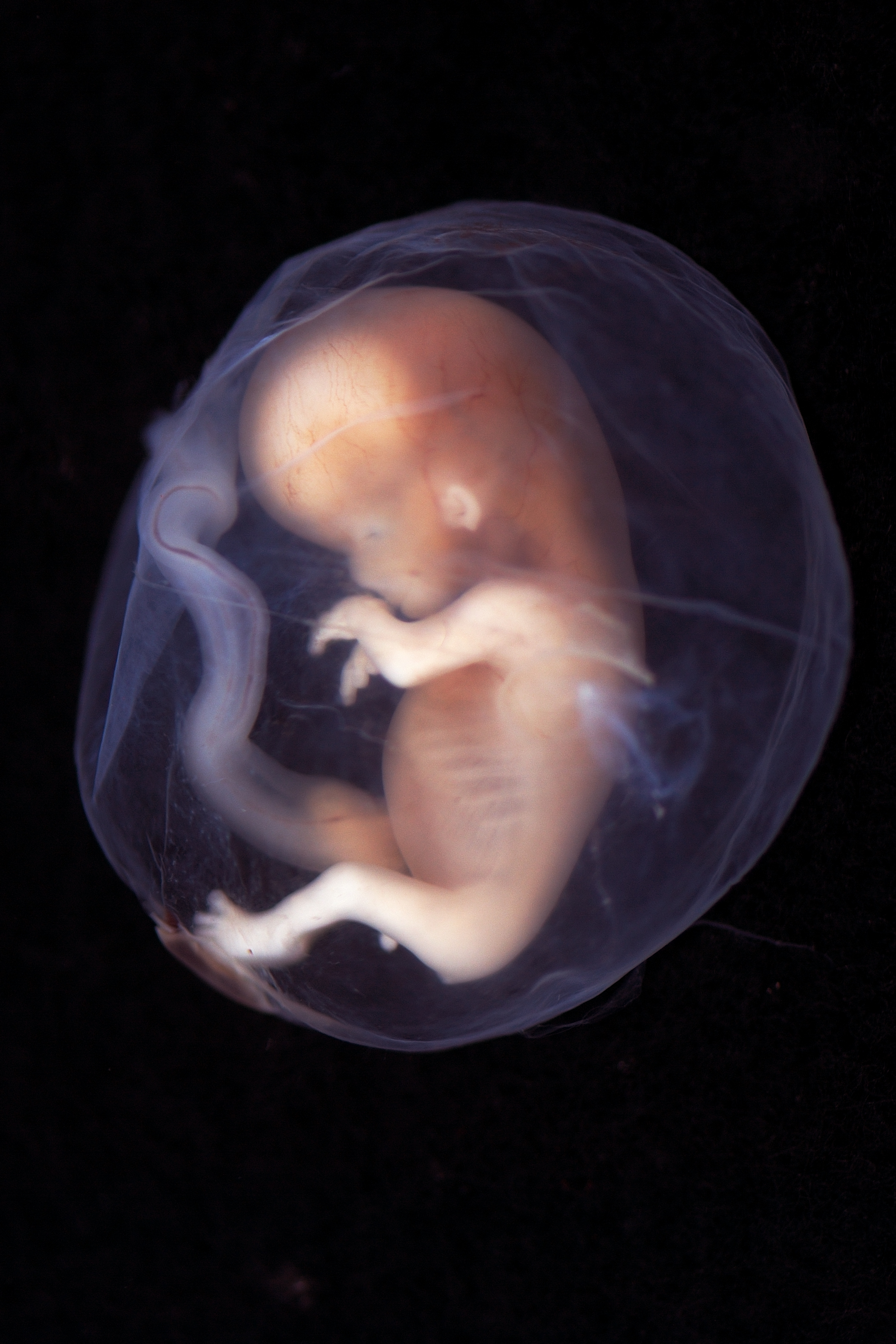 Как выглядит плод в 10 недель в утробе матери фото