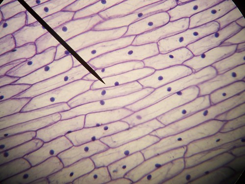 An analysis of the microscopic view of onion cells