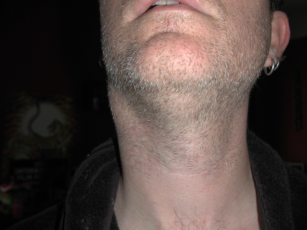 lump inside neck that moves