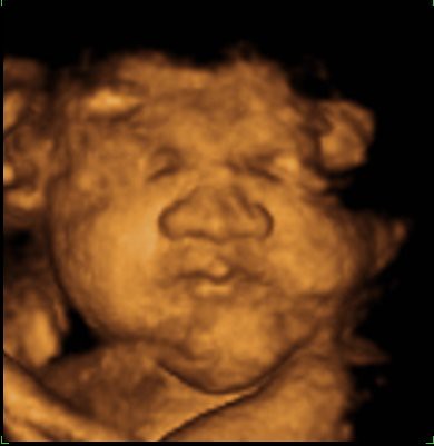 Ultrasound 29 weeks | Caden's 4D ultrasound at 29 weeks 