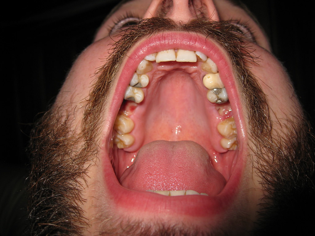 Pictures Of Inside Of Mouth 45