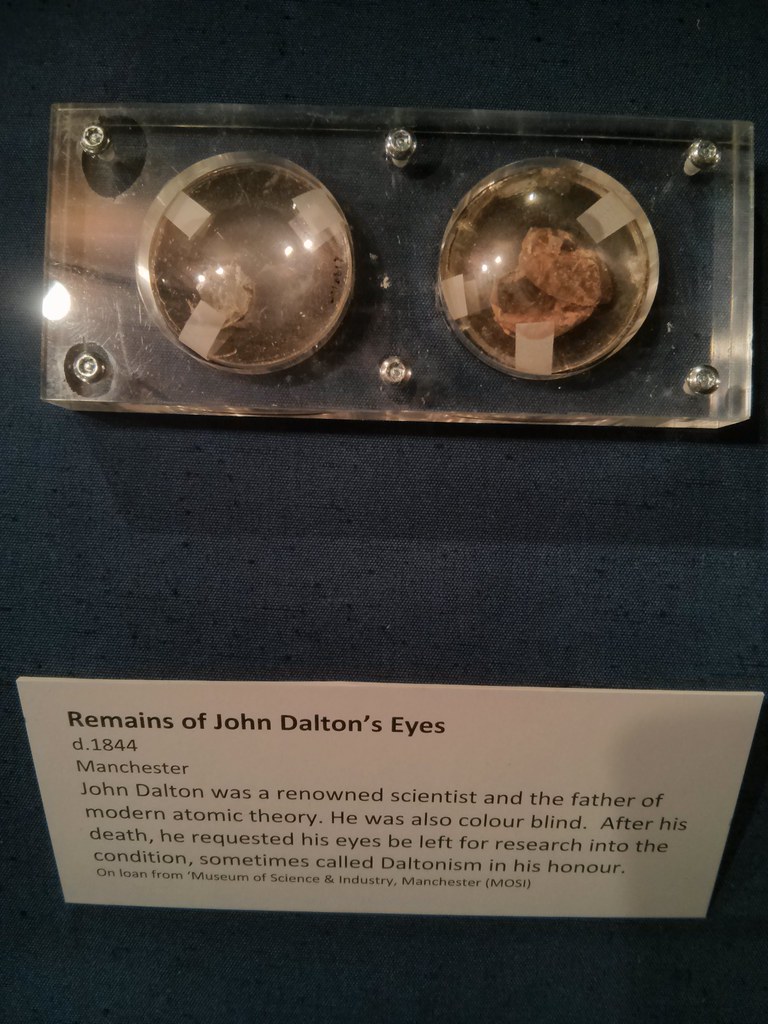 Image of the remains of John Dalton's eyes
