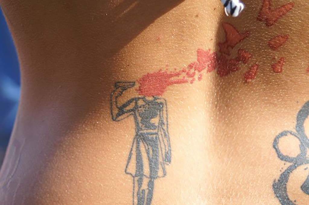 Tattoos covering up birthmarks: The most creative scar & birthmark tattoos & tattoo ideas – Suicide