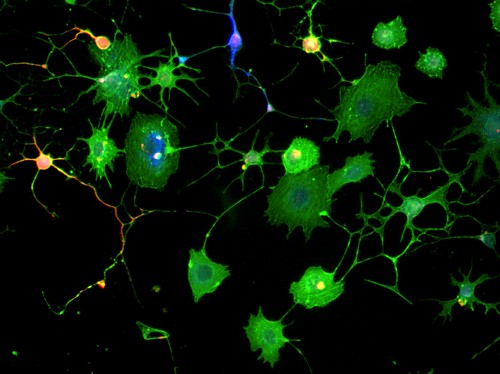 neural stem cell ile ilgili görsel sonucu