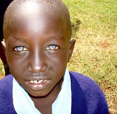 Blue Eyes... | Deaf Kenyan boy whose disability resulted fro… | Flickr