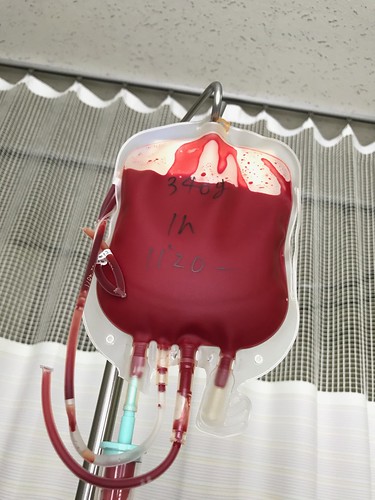 赤血球を輸血