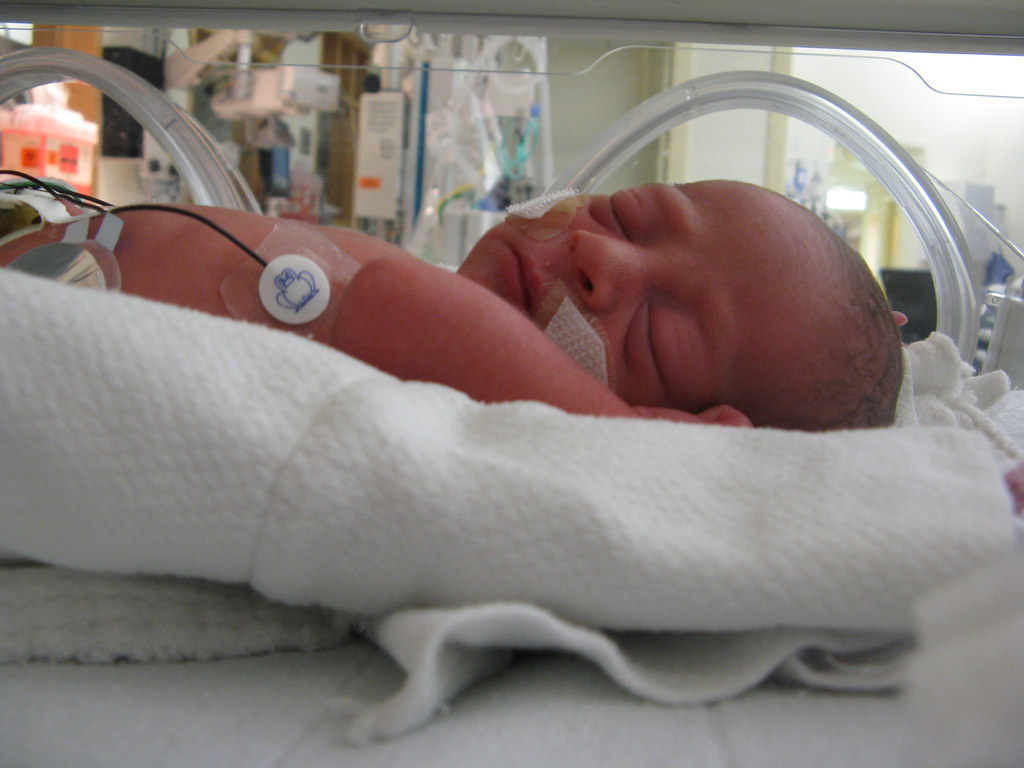 content-for-a-baby-in-the-nicu-he-sure-looks-content-here-jim-lynch