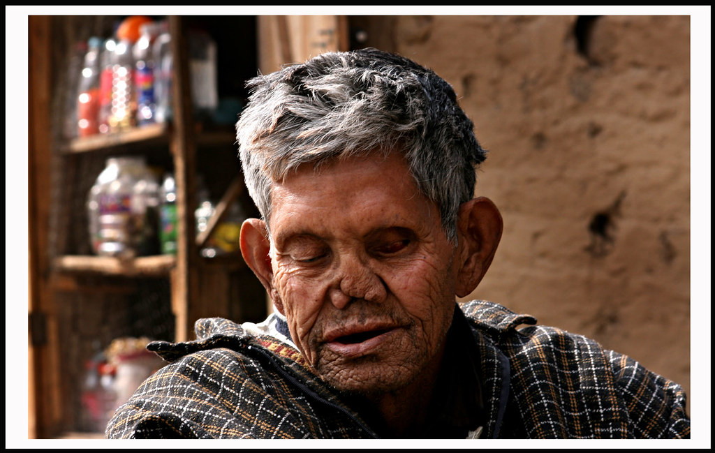 ... INDIA KASHMIR LEPROSY PATIENTS | by AAbid Bhat - 4359304832_821143dfaf_b