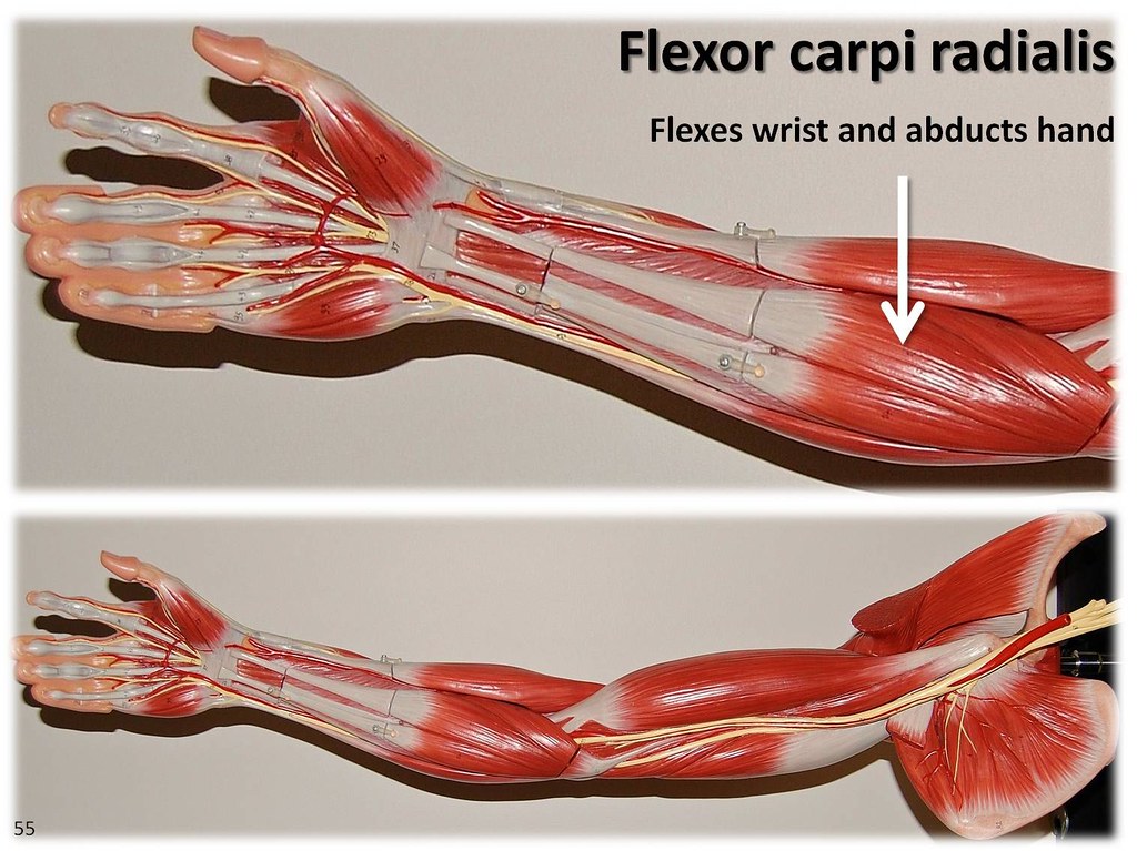 Flexor carpi radialis - Muscles of the Upper Extremity Vis… | Flickr