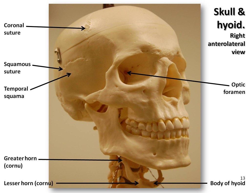 Skull, anterolateral view with labels - Axial Skeleton Vis… | Flickr