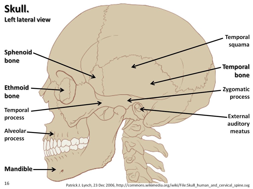 Skull diagram, lateral view with labels part 2 - Axial Ske ...