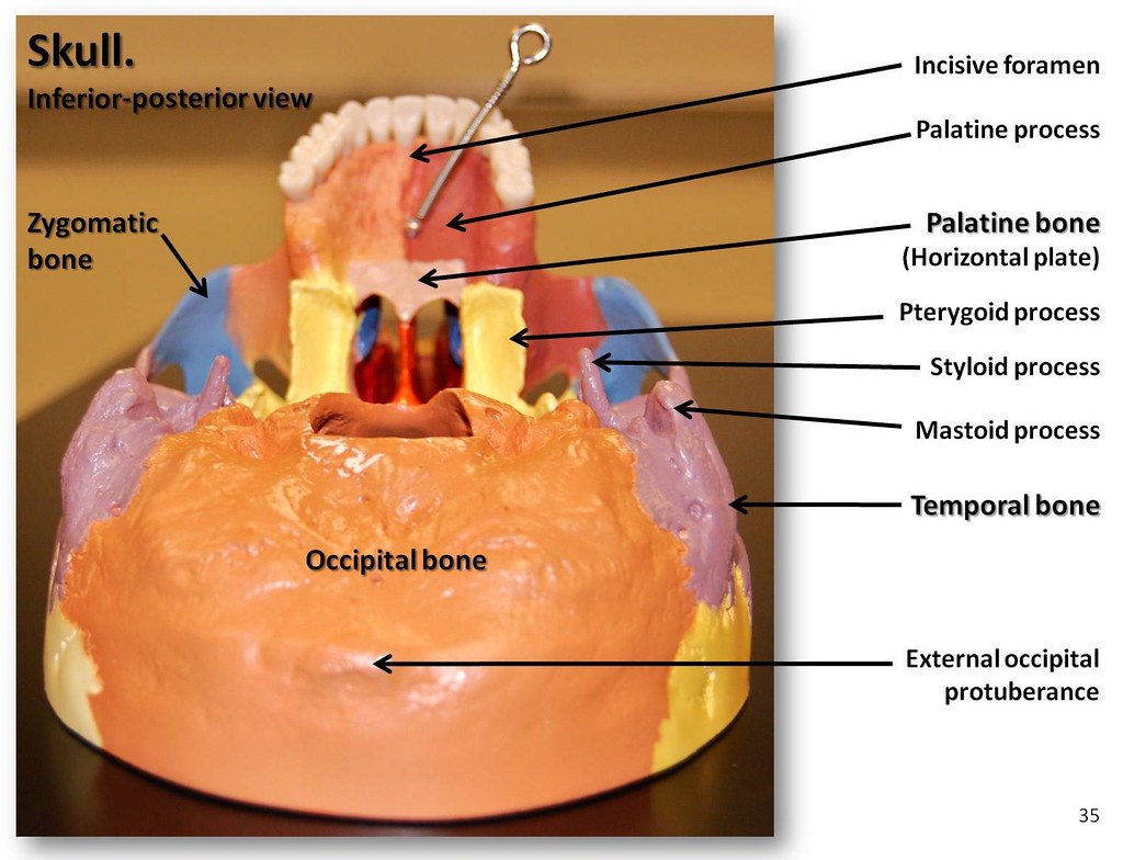 spenoid bone colored anatomy