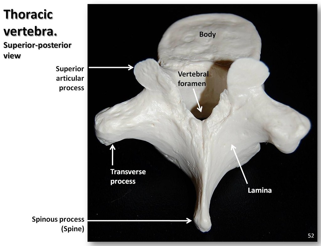 Thoracic vertebra, posterior-superior view with labels - A… | Flickr