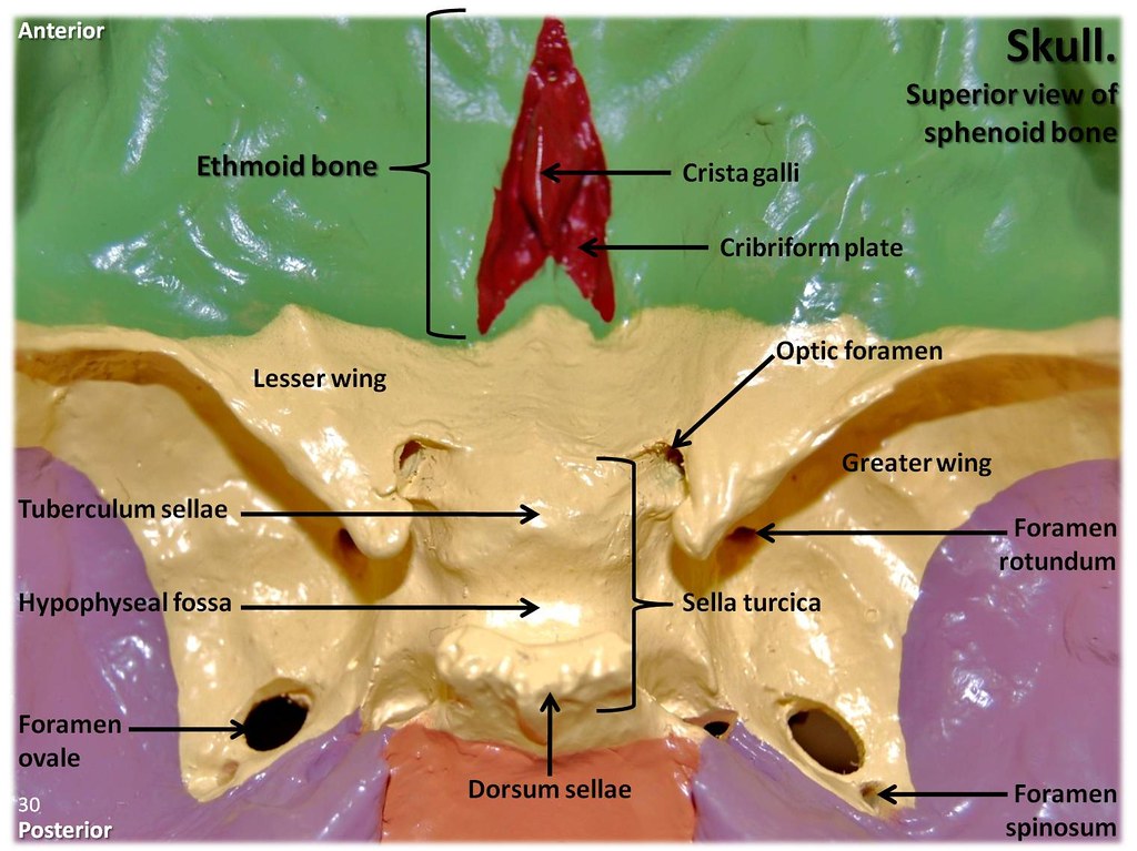 Multi-colored Skull, superior view of ethmoid and sphenoid… | Flickr