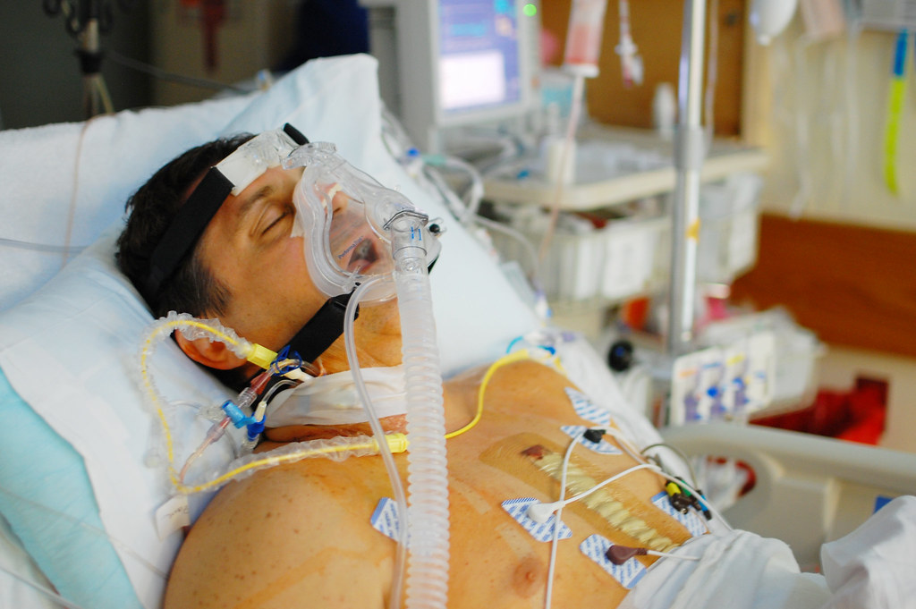 Mark in the ICU after open heart surgery. | The past few day… | Flickr