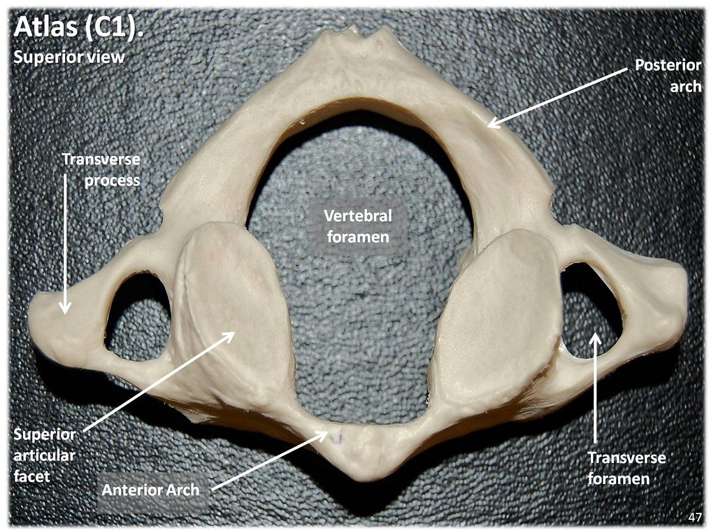 Atlas C1 vertebra, superior view with labels - Axial Skele… | Flickr