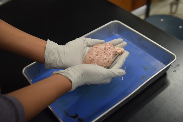 FFPN Brain Dissection