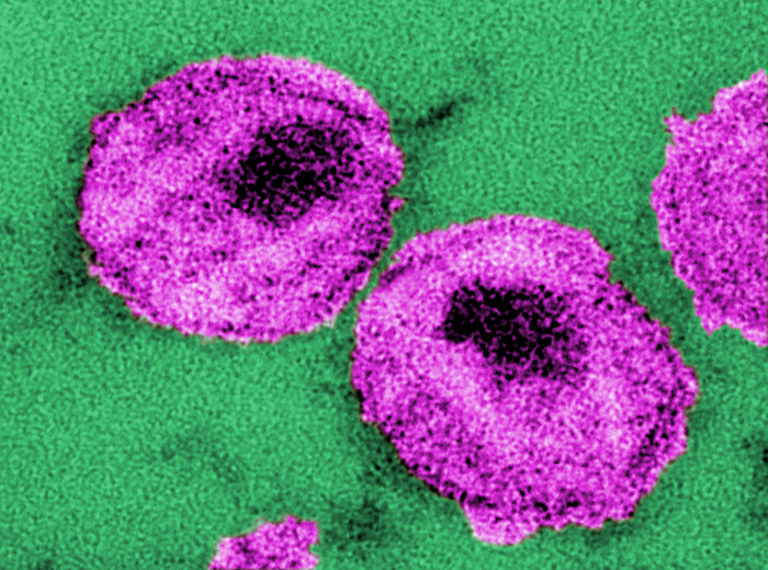 Transmission electron microscopy thin section of HIV virus particles. The dark shadow in the center of each virus is the core where the RNA is stored.