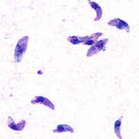 弓漿蟲（Toxoplasma_gondii_tachy）。圖片來源：the DPDx Parasite Image Library (Public Domain)。