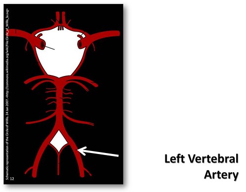 Left vertebral artery - The Anatomy of the Arteries Visual… | Flickr
