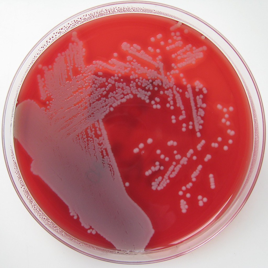 Staphylococcus aureus on Columbia Horse Blood Agar (2) | Flickr