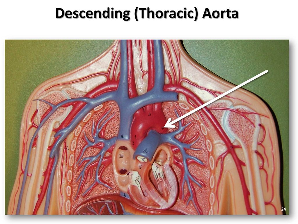 Descending (Thoracic) aorta - The Anatomy of the Arteries … | Flickr