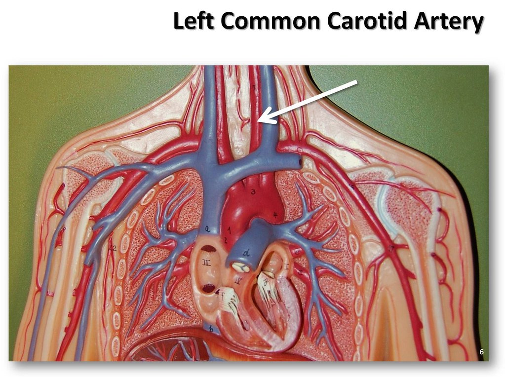 Left common carotid artery - The Anatomy of the Arteries V… | Flickr