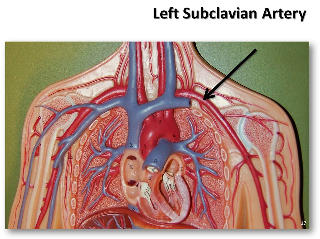 Left subclavian artery The Anatomy of the Arteries Visua