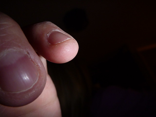 Nasty Nails | Flickr - Photo Sharing!