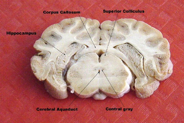 Sheep Brain Coronal 3 | Coronal Section through cerebral aqu… | Flickr