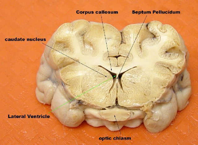 Sheep Brain Coronal 1 | Coronal Section taken at level of op… | Flickr