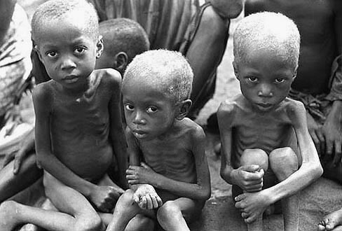 Bilderesultat for africa kid starving